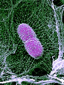 Klebsiella pneumoniae bacterium,SEM