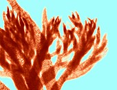Red algae,light micrograph