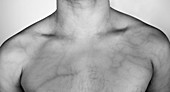 Shoulders and chest,infrared image