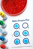 Streptococcus grouping test