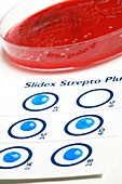 Streptococcus grouping test