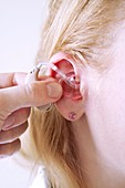 Hearing aid mould fitting