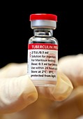 Mantoux solution,tuberculosis test