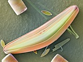 Diatom frustules (SEM)