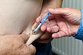 Filgrastim injection for leukaemia