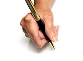 Rheumatoid arthritis hand writing