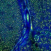 Kidney blood vessels,confocal micrograph