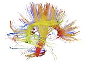 White matter fibres of the human brain