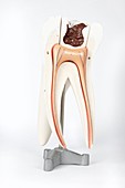 Human tooth,historical anatomical model