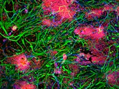 Stem cell-derived nerve cells
