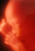 Human foetus in the womb