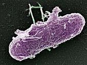 Burkholderia cepacia bacterium