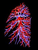 Lung blood vessel,artwork