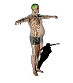 Obese man,anatomical artwork