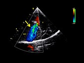 Python cardiology examination