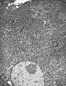 Hepatocyte liver cell,TEM