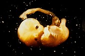 Human embryo,7 weeks old