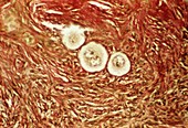 Primordial egg follicles in an ovary