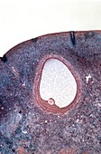 Ovarian follicle,light micrograph