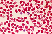 Blood cells,light micrograph