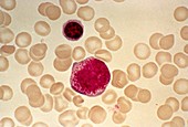 Myeloblast blood cell,light micrograph