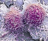 Liver cancer cells,SEM