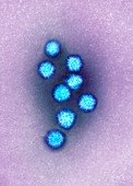 Schmallenberg virus particles,TEM