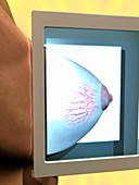 Mammogram,conceptual image