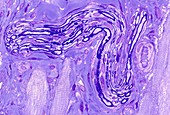 Myelinated nerve,light micrograph