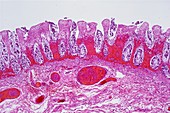 Ischaemic bowel,light micrograph