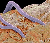 Threadworms in the gut,SEM
