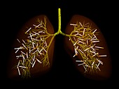 Smoker's lung,conceptual artwork