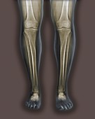 Normal legs,X-rays