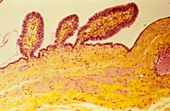 Paratubal cysts,light micrograph