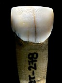 Homo heidelbergensis tooth