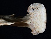 Homo heidelbergensis arthritic jaw