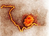 Measles virus particle,TEM
