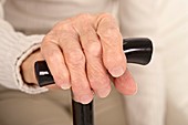 Arthritic hand and walking stick