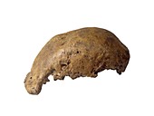 Homo erectus cranium