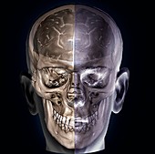 Human head,MRI and 3D CT scans