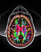 Human head and brain,DTI and 3D CT scans