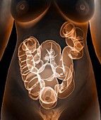 Healthy large intestine,3D CT scan
