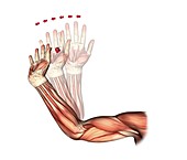 Elbow and wrist extension,artwork