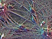 Brain nerve cells,SEM