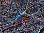 Brain nerve cells,SEM
