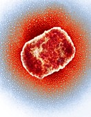 Monkeypox virus particle,TEM