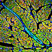 Heart muscle,fluorescence micrograph