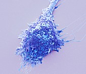 Microglial white blood cell,SEM