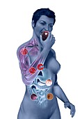 Diabetic woman,artwork