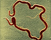 Syphilis bacterium,TEM